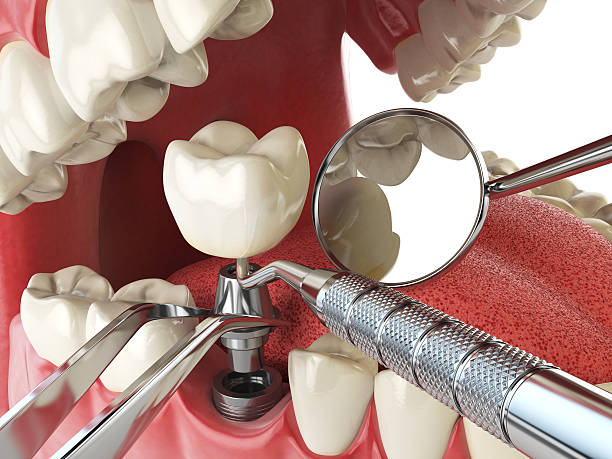 Best Pediatric Emergency Dentist in Meraux, LA